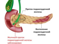 Диета при панкреатите- подробное меню