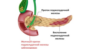 Диета при панкреатите- подробное меню